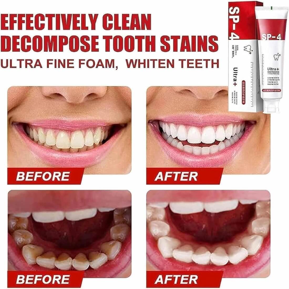 Stain Remover & Fresh Breath Formula