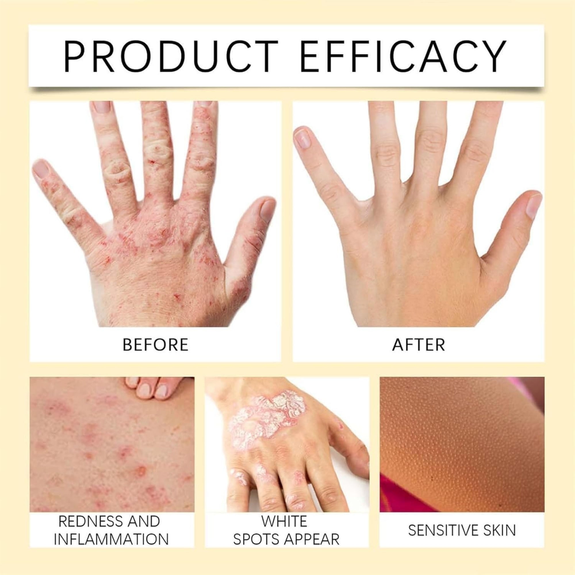 Natural Skin Repair Hydration Relief Anti-Irritation